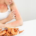 Alergia alimentaria vs. intolerancia: ¿cuál es la diferencia?