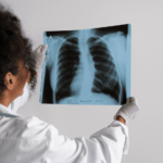Hipertensión arterial pulmonar: una enfermedad rara y silenciosa que exige diagnóstico temprano y acceso a tratamiento médico
